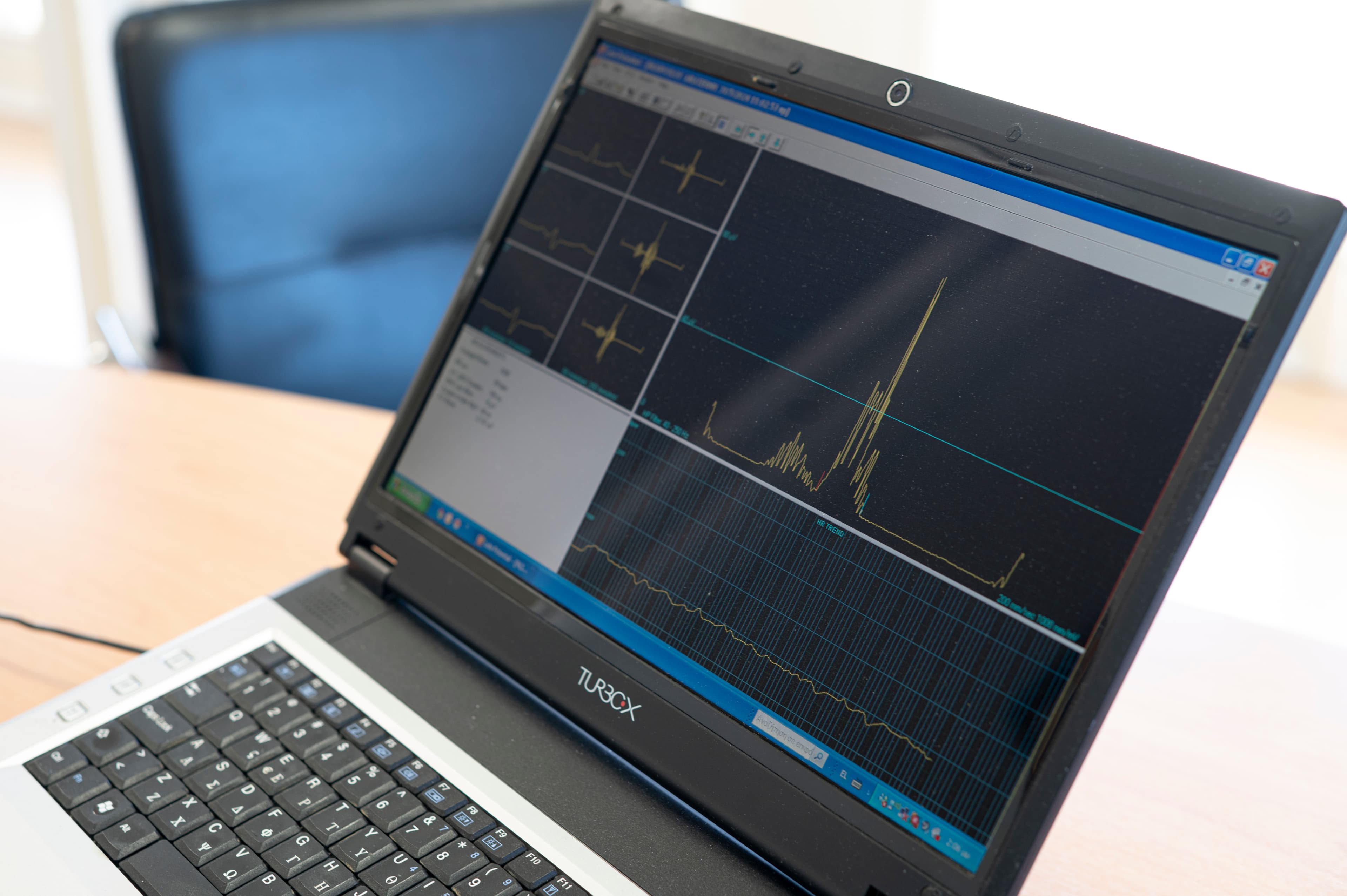 Υπερηχογράφος